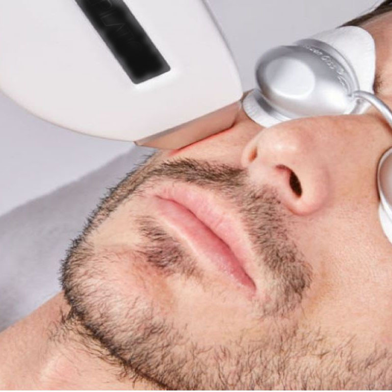 DEPILAZIONE LASER  UOMO