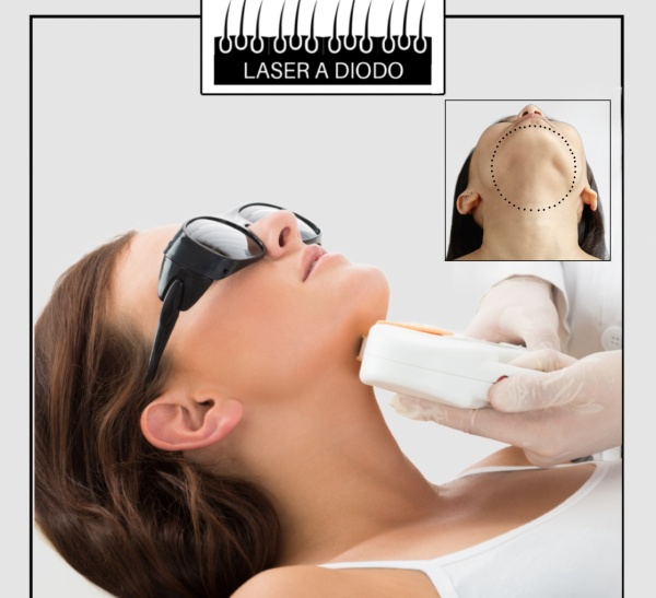 EPILAZIONE LASER A DIODO MENTO DIFFUSO