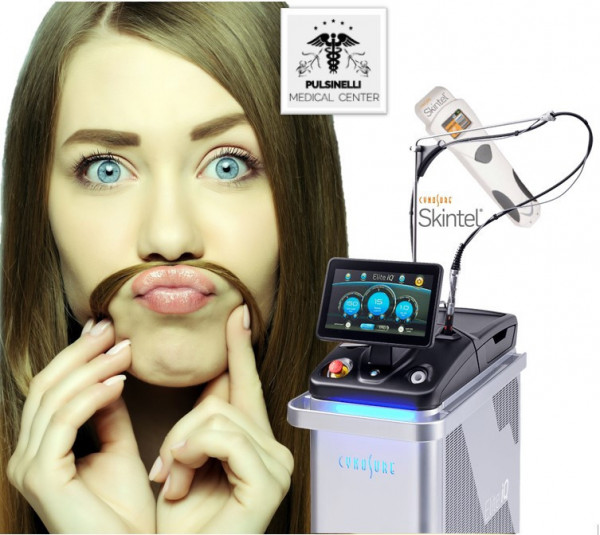 EPILAZIONE MEDICA LASER ALESSANDRITE : ZONA BAFFETTO