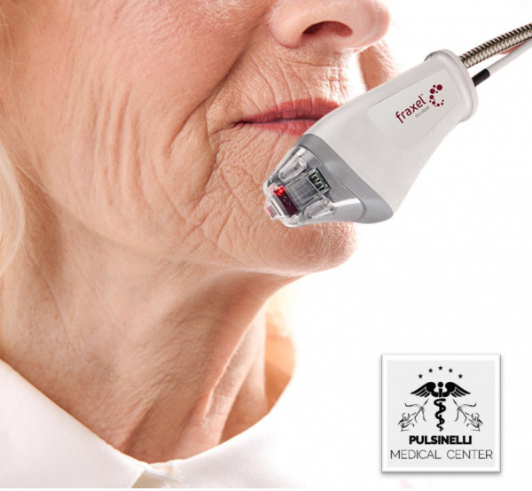 LASER SKIN RESURFACING: PER IL RINGIOVANIMENTO DELLA PELLE