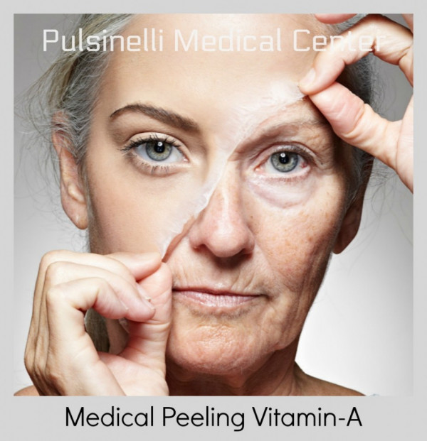 MEDICAL PEELING PER ACCELLERARE IL RINNOVAMENTO DELLA PELLE