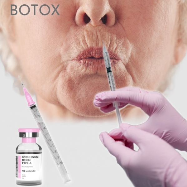 BOTOX PER LE RUGHE DEL CODICE A BARRE