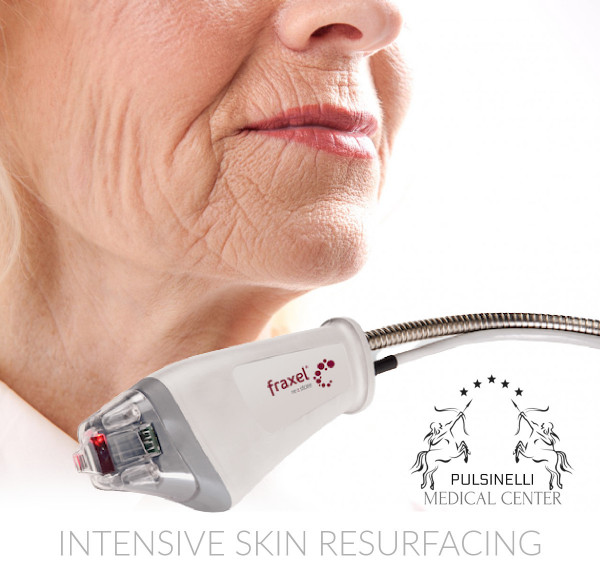 LASER FRAXEL : PROTOCOLLO INTENSIVE SKIN RESURFACING