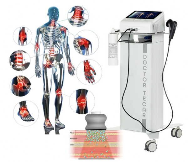 TECARTERAPIA PER GUARIRE VELOCEMENTE: DIECI SEDUTE DA 40 MINUTI