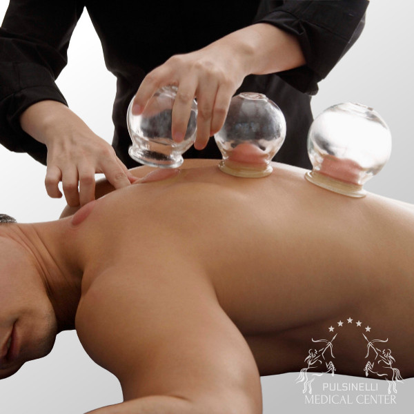 CUPPING THERAPY: seduta da 30 minuti
