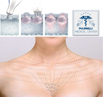 BIORIVITALIZZAZIONE COLLO E DECOLLETE’: PRODIGIO DI BELLEZZA - 3 sedute