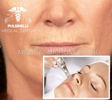 MEDICAL MICRONEEDLING PER ELIMINARE IL CODICE A BARRE