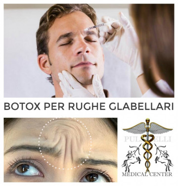 TRATTAMENTO DELLE RUGHE GLABELLARI CON BOTULINO