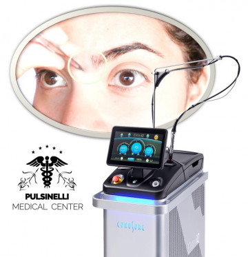 EPILAZIONE MEDICA LASER ALESSANDRITE : ZONA GLABELLARE