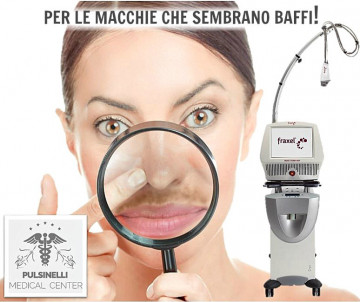 LASER FRAXEL PER LE MACCHIE CHE SEMBRANO BAFFI