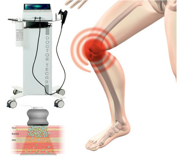 TECARTERAPIA PER GUARIRE VELOCEMENTE: 10 SEDUTE DA 20 MINUTI