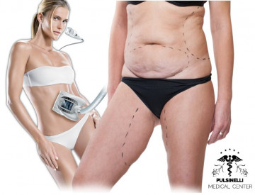 ALLIANCE MEDICAL DI LPG : PROTOCOLLO LASSITA’ TOTAL BODY