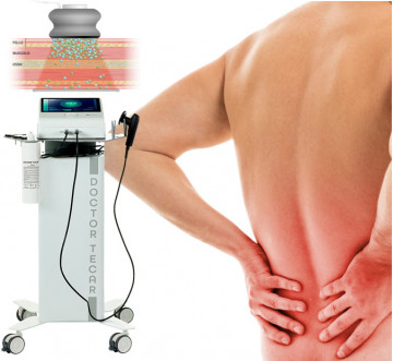 TECARTERAPIA PER GUARIRE VELOCEMENTE : SEI SEDUTE DA 40 MINUTI