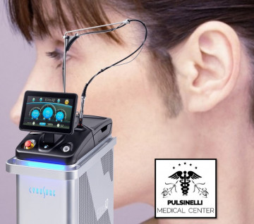 EPILAZIONE MEDICA LASER ALESSANDRITE : BASETTE CIRCOSCRITTE