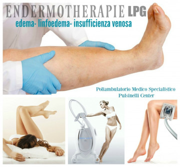 ENDERMOTHERAPIE LPG :PROTOCOLLO INSUFFICIENZA VENOSA - EDEMI - LINFOEDEMI
