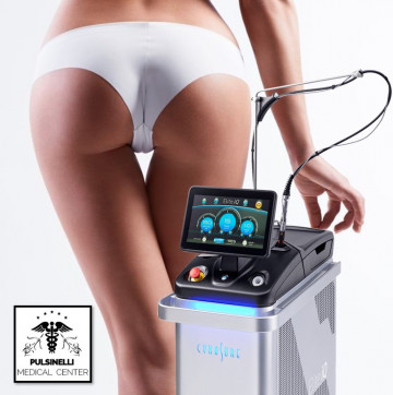 EPILAZIONE MEDICA LASER ALESSANDRITE : ZONA CANALE GLUTEI