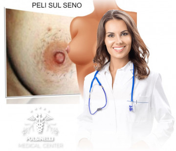 EPILAZIONE MEDICA LASER ALESSANDRITE : ZONA SENO