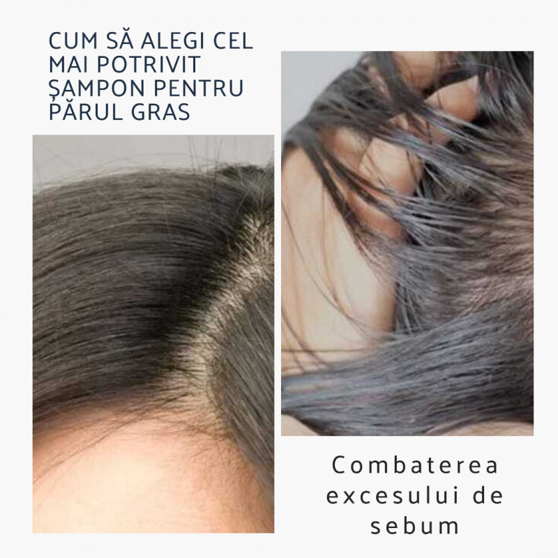 Secretele unui păr strălucitor și sănătos: Cum să alegi cel mai bun șampon pentru părul gras!