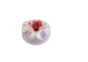 Orchidea serpenyő - Műanyag vágók Ø 5,7 - 9,6 cm, 3 db-os készlet - Img 3
