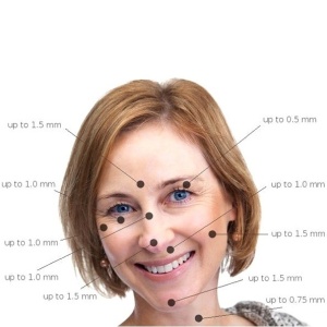Derma Roller za kućnu i profesionalnu upotrebu. Najbolja anti age nega - Img 6
