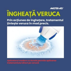 Aplicatorul cu burete îngheață veruca prin crioterapie
