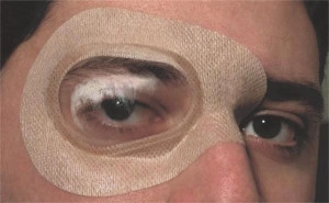 Ortolux Air – Protecţie oculară sterilă, autoadezivă, cu valvă transparentă găurită - Img 2
