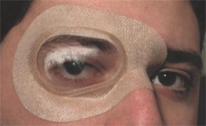Ortolux – Protecţie oculară sterilă, autoadezivă, cu valvă transparentă - Img 2