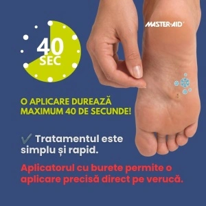 Crio Spray Verruche aplicat pe o verucă plantară
