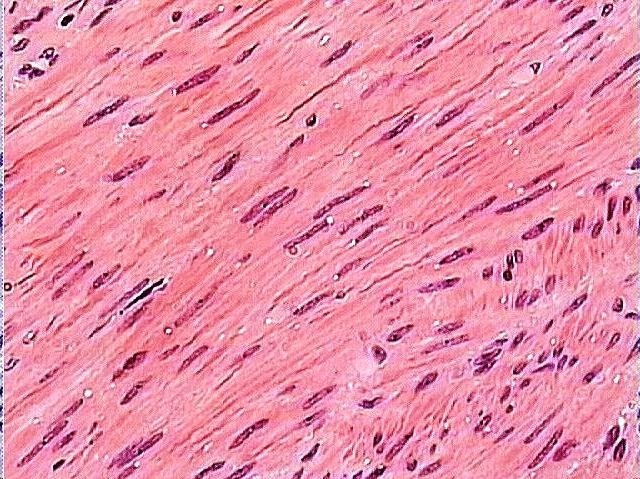 Țesut muscular striat