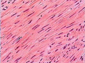 Mușchi neted - probă microscopică