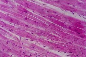 Mușchi cardiac - probă microscopică