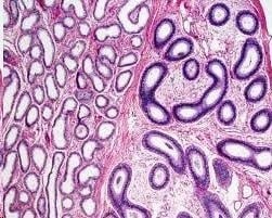 Etapele meiozei - probă microscopică