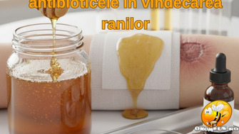 Descoperire uimitoare: mierea, mai eficienta decat antibioticele in vindecarea ranilor grave