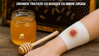 Descoperire medicala uimitoare: Rani cronice tratate cu succes cu miere cruda – studiu revolutionar