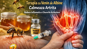 Descoperire Medicala Uimitoare: Terapia Cu Venin De Albine Calmeaza Artrita? Reduce Inflamatia Si Durerile Articulare?