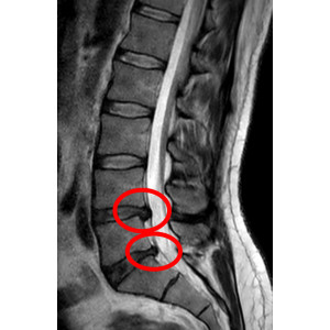 Heel Zeel Comp N 350 Tablete - Produs Homeopat, Tratament Antireumatic ~ Coxartoza, Gonartroza, Dureri articulare, Afectiuni Reumatismale, Reumatism Poliarticular, Fracturi Osoase, Inflamatii articulare - Img 2