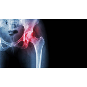 Heel Zeel Comp N 350 Tablete - Produs Homeopat, Tratament Antireumatic ~ Coxartoza, Gonartroza, Dureri articulare, Afectiuni Reumatismale, Reumatism Poliarticular, Fracturi Osoase, Inflamatii articulare - Img 3