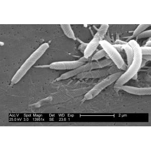 Tratament Naturist Helicobacter Pylori Eficient Surse Naturale Brocoli Sulforaphane Mastic Gum Colostrum - Natural 2 Luni - Img 3