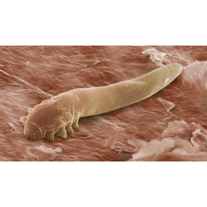 Protocol Deparazitar Hulda Clark Forte 10-35 zile Adulti si Copii Eliminare Paraziti Intestinali - Img 3