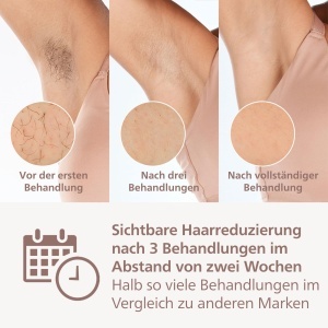 Aparat IPL Philips Lumea Seria 9000 BRI95700 SenseIQ Tehnologie 4 accesorii utilizare wireless - Img 3
