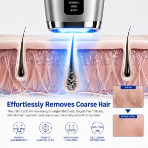 Epilator IPL Mulbijeo, 21J, 999.999 impulsuri, cu functie de racire - Img 3