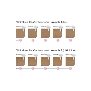 Epilator IPL Philips Lumea Prestige SC199700 pentru fata si corp Tehnologie Intense Pulsed Light - Img 5