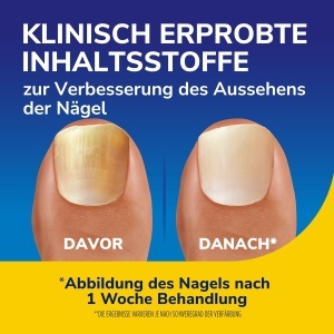 Serum pentru unghii Dr Scholls 10 ml Revitalizare Rapida 3-in-1 - Img 3