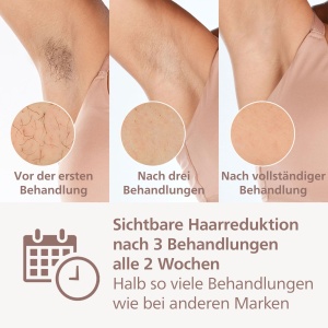 Dispozitiv de epilare Philips Lumea seria IPL 8000 cu tehnologie SenseIQ - alternativa la epilarea cu laser, 3 atasamente pentru corp, fata si zone de precizie (BRI946/00) - Img 3