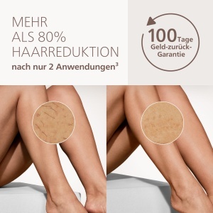 Dispozitiv IPL pentru indepartarea parului Philips Lumea 9000 BRI98100, 4 aplicatoare - Img 3