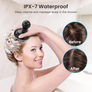 Dispozitiv de Masaj pentru Scalp COMFIER, 4 Capete, Reincarcabil, Waterproof - Img 2