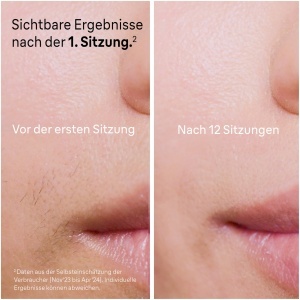 Dispozitiv IPL pentru Epilare Braun Skin iexpert 7, AlbRoz, 5 Ani Garantie - Img 5