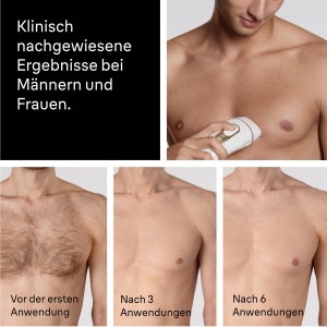 Epilator IPL Braun Silk-expert Pro 5 PL5220 AlbAuriu - Img 10