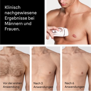 Epilator IPL Braun Skin iexpert 7 PL7311 Rosegold - Img 13