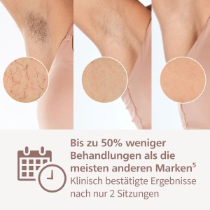 Epilator IPL Philips Lumea 9900 Series BRI95302, 3 accesorii, cablu si wireless - Img 4